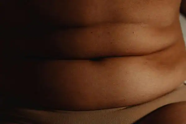The Hidden Connection: How Stress Shapes Your Fitness and Body Composition 3 image of what stress can do on the stomach area and how Lipo 360 West Drayton can help to change your body shape.